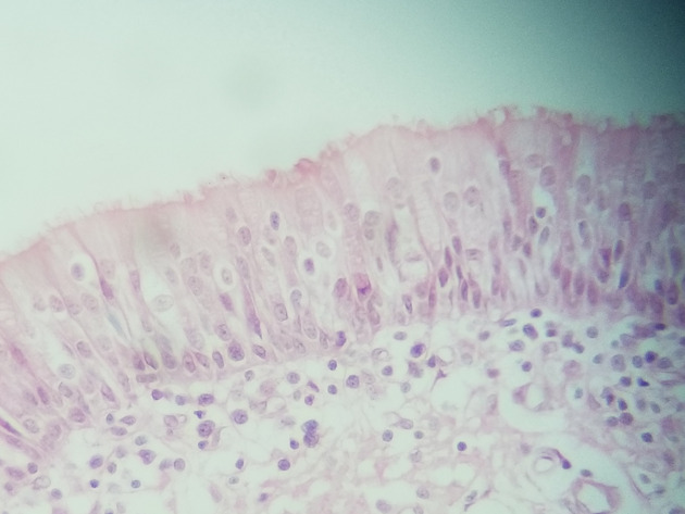 Pseudostratified Epithelium Slides - Pseudostratified Epithelium 15 400X